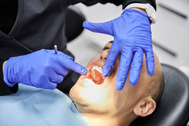Best Emergency Dental Care for Broken or Chipped Teeth in Lincroft, NJ